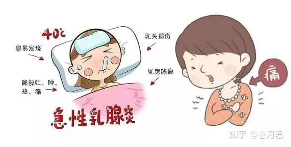 乳腺炎反復(fù)發(fā)作？這6個(gè)方法很管用