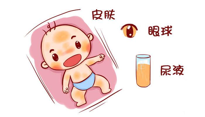 新生兒出生沒黃疸，大多是孕媽在孕期做了3件事