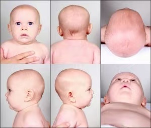 育兒小妙招|4個小妙招，幫寶寶睡出好頭型，趕緊收藏