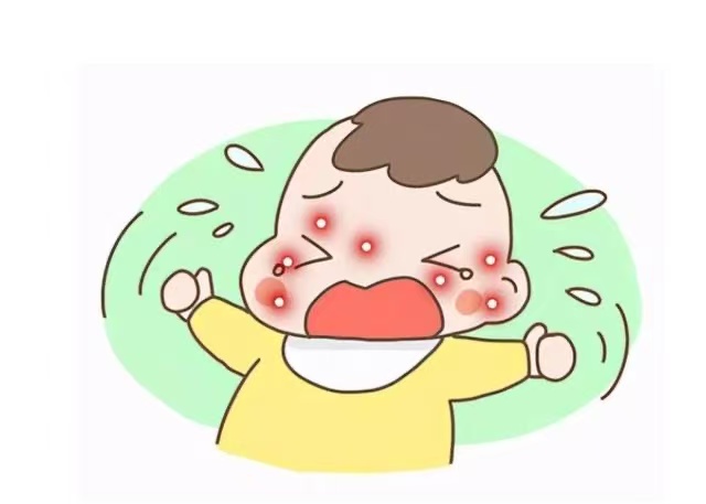 孩子濕疹反復(fù)發(fā)作怎么辦？這些防治方法請收好！